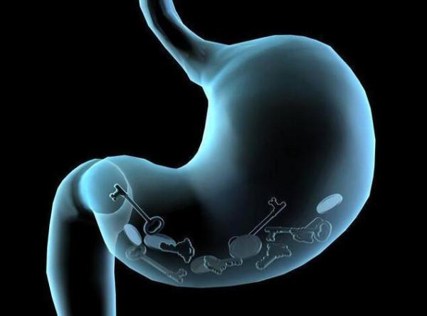 教你如何看胃鏡報告，提醒：報告若出現這3個詞，請提高警惕