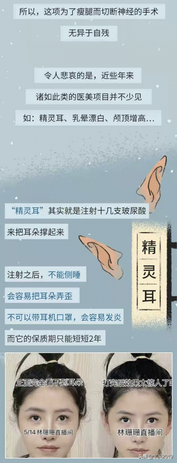 為“變美”挑斷小腿、弄殘耳朵?女人整容有多魔怔?#漫畫# 為“變美”挑斷小腿、弄殘耳朵?女人整容有多魔怔?#漫畫#