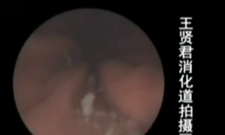 丈夫去世2天后，竟穿著壽衣坐在客廳，妻子：誰還敢跟他一起住