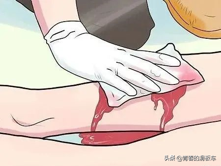 透析相關用藥大全!收藏 透析相關用藥大全!收藏