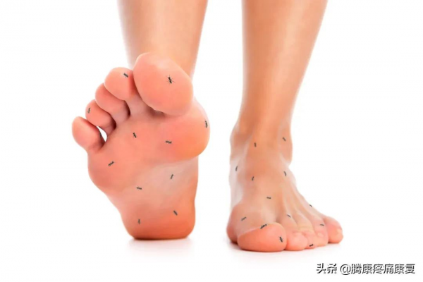 是什麼引起的肌肉抽搐？需要治療嗎？