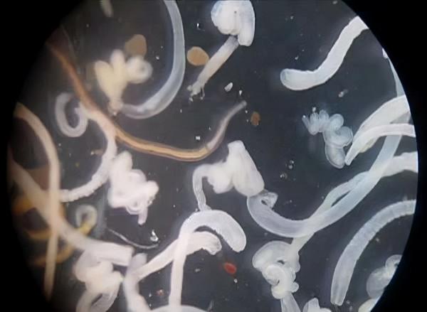 顯微鏡下，它們含有上萬條寄生蟲，大家都吃過，看完還敢吃不？