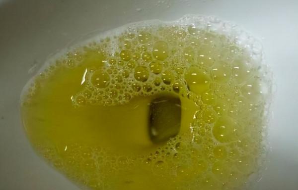 男性晨起“第一次”上廁所，若沒有3種現象，或表明腎功能健康