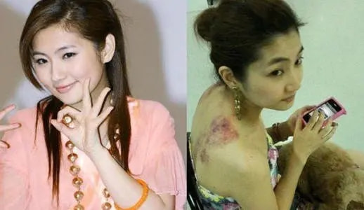 5位“毀容”的明星,胡歌“鬼門關”逃了出來,王心凌令人惋惜 5位“毀容”的明星,胡歌“鬼門關”逃了出來,王心凌令人惋惜