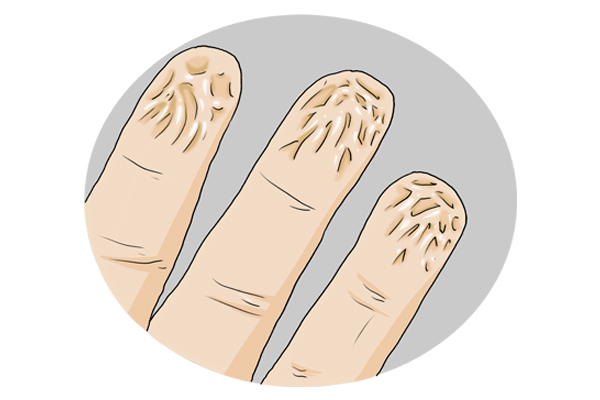 為什麼洗澡、游泳時間長了手指頭會起皺？其他部位為什麼沒變化？