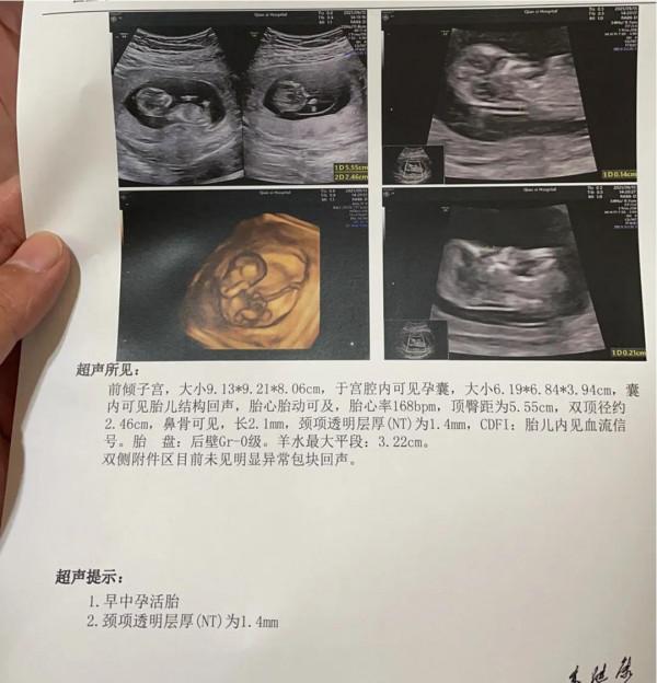 生男生女都一樣