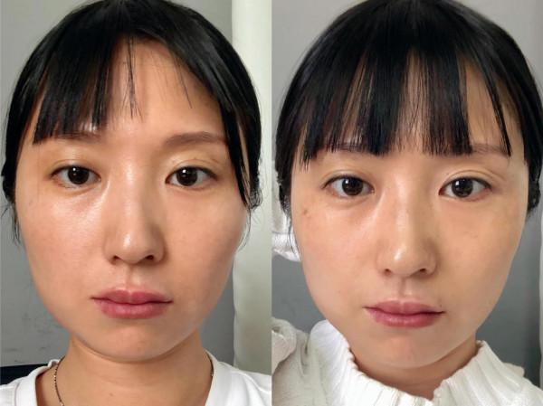 面部瑜伽鍛鍊一個月效果 面部瑜伽鍛鍊一個月效果