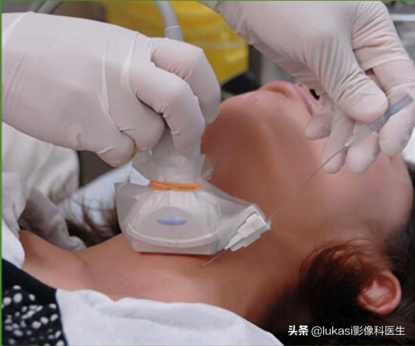 什麼是甲狀腺癌？看看專家是怎麼說的