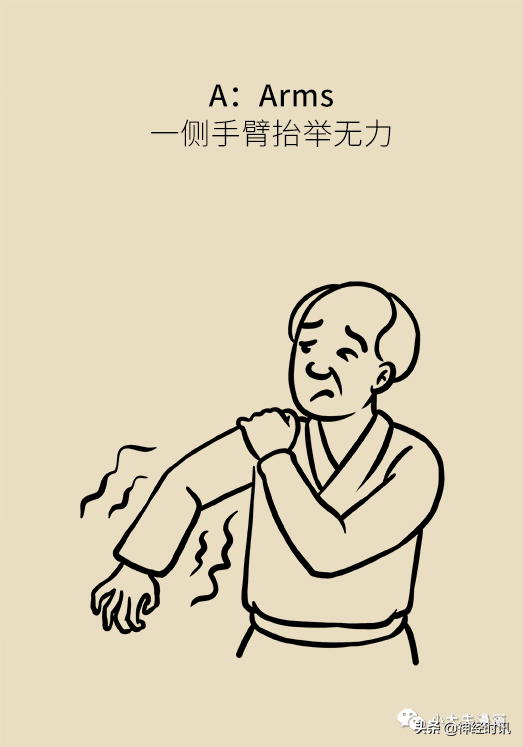 “腔隙性腦梗”到底怎麼回事？這篇文章全說透了