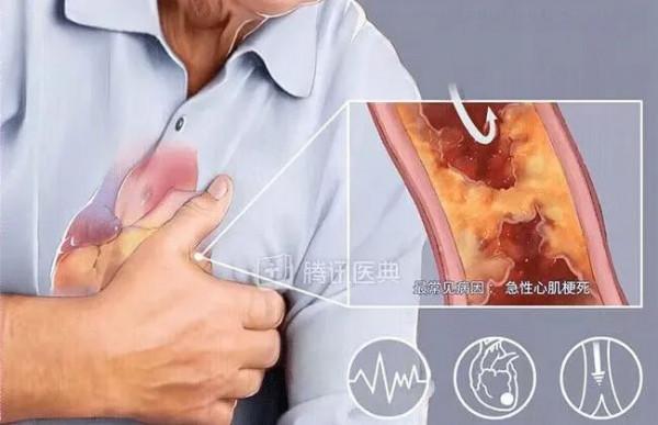 經常吸二手菸對於冠心病患者的危害有哪些？