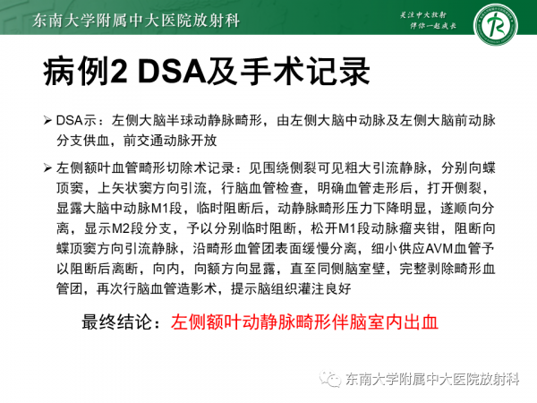 腦動靜脈畸形影像學特徵