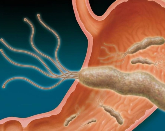 突發心梗，速效救心丸和硝酸甘油，哪個才能緊急救命？