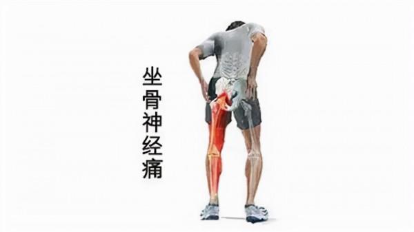 久坐腰腿屁股痛？三個動作輕鬆緩解