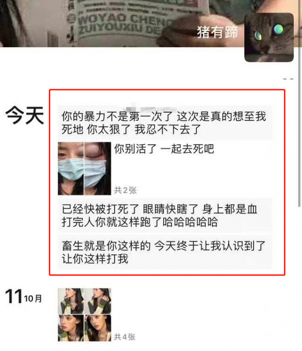 百萬網紅疑遭男友家暴，眼睛青紫滿臉抓痕，傷勢過重讓人認不出