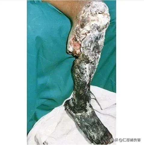 柳宗元的《捕蛇者說》中，永州產異蛇，究竟是什麼蛇？