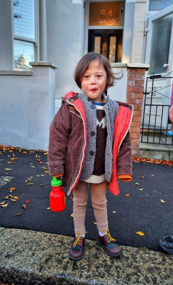 現實版拇指姑娘 出生時比手套還小 現在已經是一個堅強的小女孩