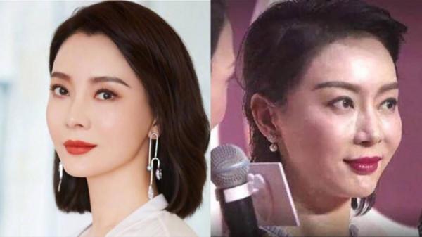 凹凸不平、眼睛擠成一條縫,“發麵饅頭”臉毀了多少高顏值明星? 凹凸不平、眼睛擠成一條縫,“發麵饅頭”臉毀了多少高顏值明星?