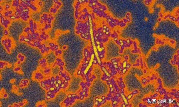 如果您年滿60歲，吃乳酪前，請一定要熟悉巴氏消毒法