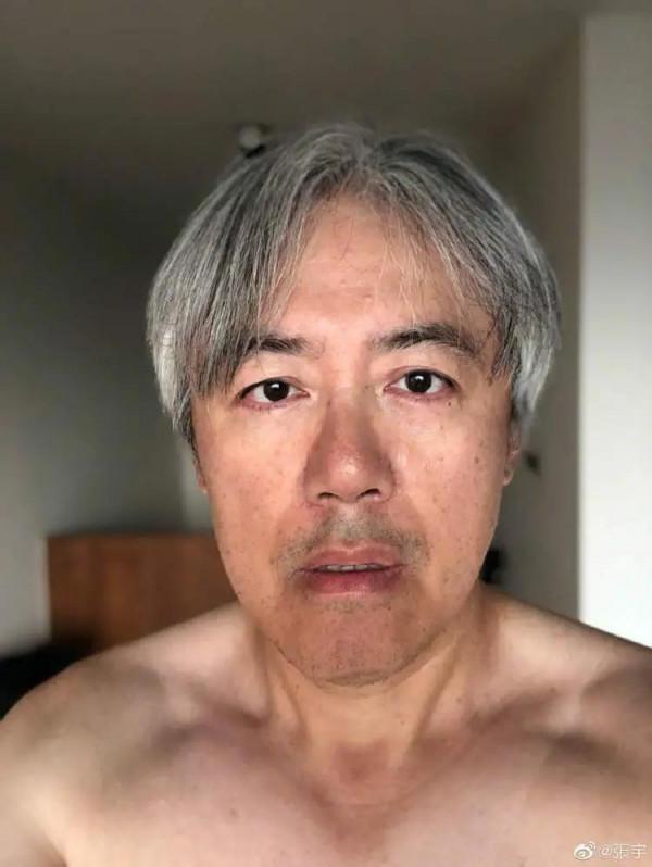 歌手張宇滿頭白髮如雪引熱議，你的臉有幾分憔悴