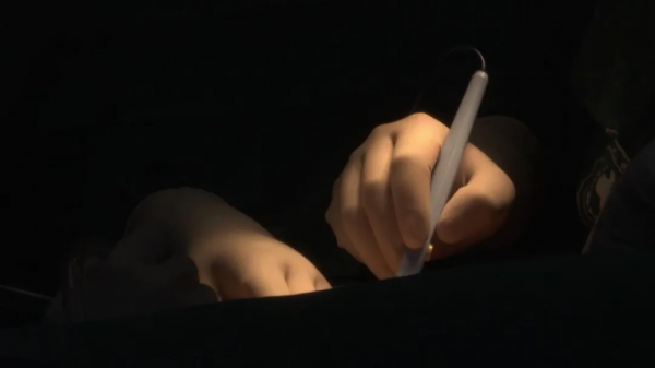 突然昏倒!查出肝破裂出血,約3000ml的血液佔據整個腹腔,原來竟然是肝臟惡性腫瘤 突然昏倒!查出肝破裂出血,約3000ml的血液佔據整個腹腔,原來竟然是肝臟惡性腫瘤