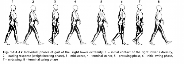 師太科普雜談 | 脊柱側彎和步態關係中的一個細節