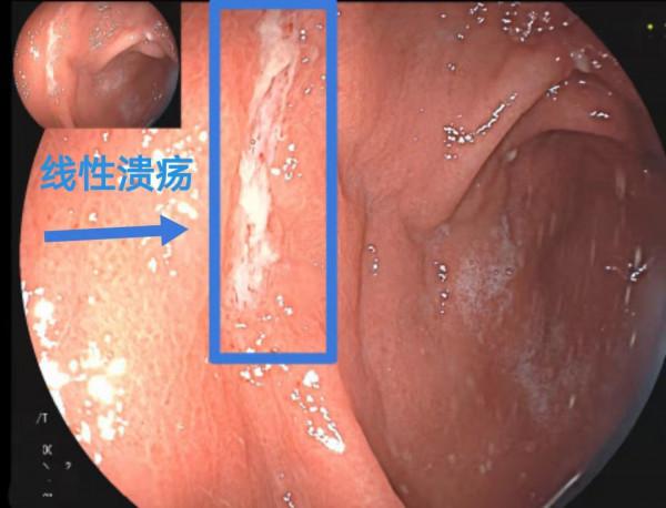 警惕&OpenCurlyDoubleQuote;春節病&rdquo;，專家提醒歡樂過新年吃喝玩要有度