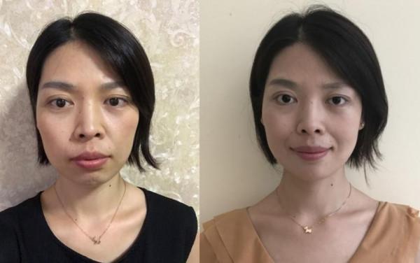 53歲陳紅聚會近照曝光，雙目無神顯疲態：3招讓你的眼睛會說話