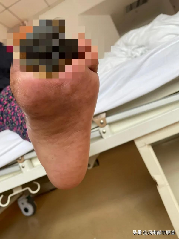 太可怕了！你還能認出這是腳嗎？