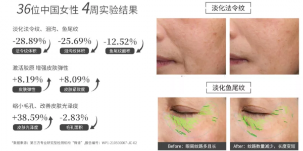 只說一次!購買「家用射頻美容儀」前請重視這個問題 只說一次!購買「家用射頻美容儀」前請重視這個問題