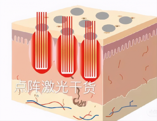 入門級醫美專案指南!美容院不告訴你的,這篇全都有 入門級醫美專案指南!美容院不告訴你的,這篇全都有