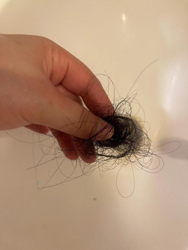 頭髮掉得厲害?你有沒有這情況 頭髮掉得厲害?你有沒有這情況