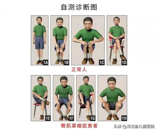 孩子下蹲“畫圈圈”，家長該注意啦！