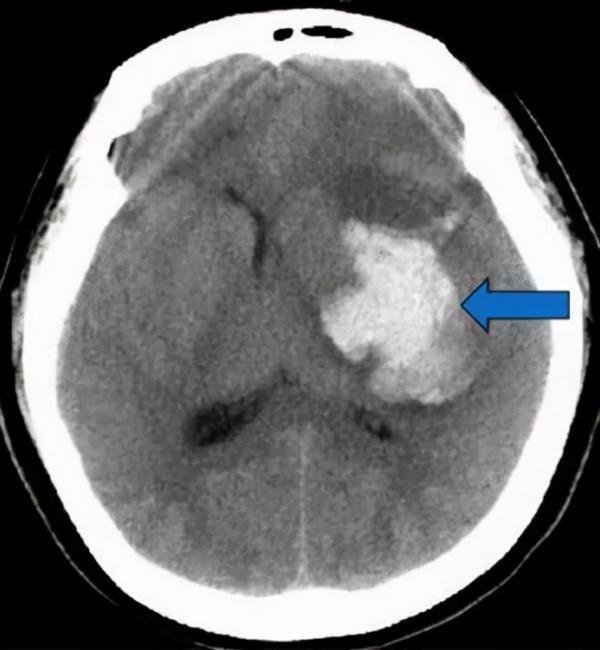 70歲父親送走40歲獨子,欲哭無淚!白髮人送黑髮人的悲劇不要重演 70歲父親送走40歲獨子,欲哭無淚!白髮人送黑髮人的悲劇不要重演