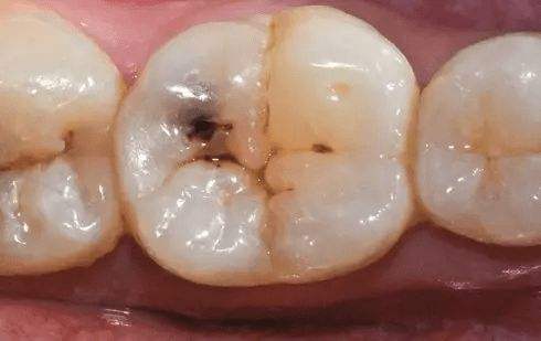 喝幾十年的茶是保護還是毀了牙？想到老還能有好牙口，該怎麼做？