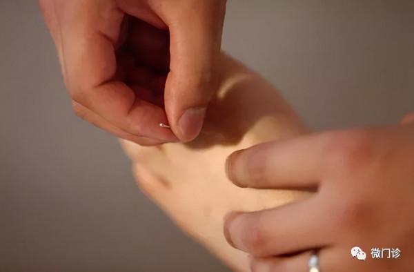 張仲景留下的化痰方！五味藥，讓痰溼從哪來，回哪去