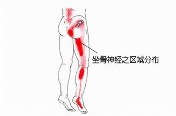 久坐腰腿屁股痛？三個動作輕鬆緩解
