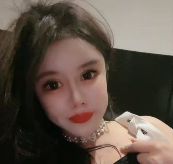 “真人芭比”周楚娜：2年半歷經100多次手術，一張臉抵一輛跑車