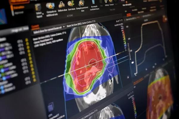 世界首例!新一代重離子療法成功臨床 世界首例!新一代重離子療法成功臨床