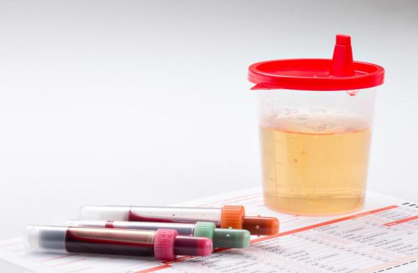 治療甲亢，常用的三種方法裡，兩種可導致不可逆的併發症