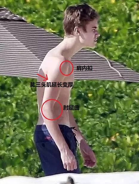 手臂粗壯肩膀厚，夏天不敢穿短袖！別練俯臥撐了，手臂越練越粗