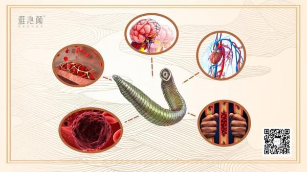 兩種中成藥，多靶點“清理血液”，從根上疏通冠脈，改善心肌缺血