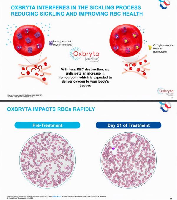 首個治療鐮狀細胞病疾病根源的藥物美國FDA批准科應症&amp;分散片劑型