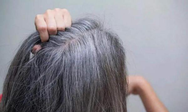 女性頭上白髮增多，別總認為老了，可能是體內缺乏這幾種營養元素