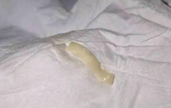 19歲男大學生腹瀉上完廁所回頭一看慌了：裡面竟有一條蟲......