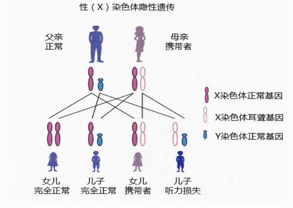 為什麼愛喝酒的人，容易得腦梗塞？這4個原因是關鍵