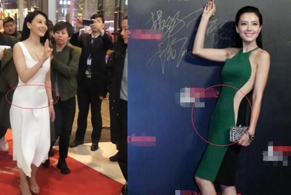 還在容貌焦慮？看看倪妮的小肚子、楊冪的雙下巴、熱巴的滿臉痘吧