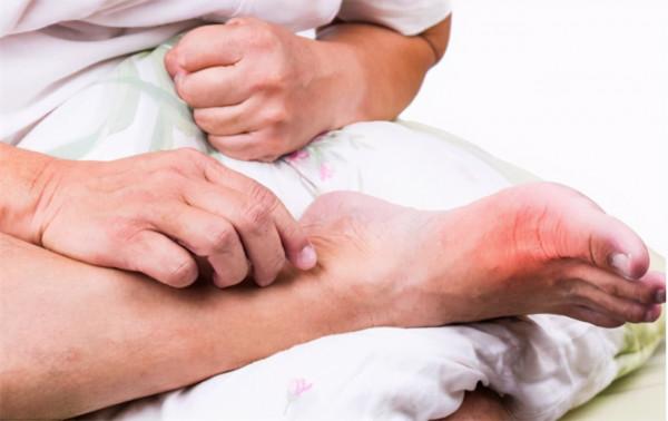 尿酸高,如何讓尿酸排出體外?醫生總結:3個辦法,實用有效 尿酸高,如何讓尿酸排出體外?醫生總結:3個辦法,實用有效