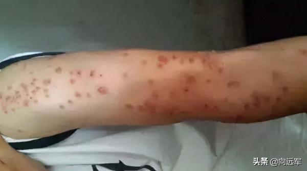 廣東臭蟲,讓人膽戰心驚 廣東臭蟲,讓人膽戰心驚