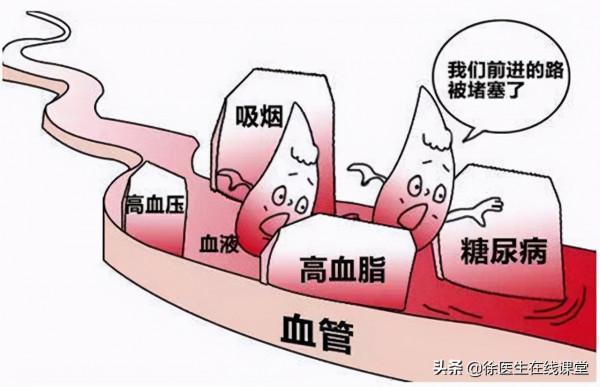 阿司匹林和他汀要吃多久?什麼時候可以停?讓醫生來告訴你 阿司匹林和他汀要吃多久?什麼時候可以停?讓醫生來告訴你