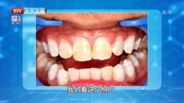 手機不能放枕邊、一次性杯子不能裝熱水&hellip;&hellip;這些火爆的&OpenCurlyDoubleQuote;健康資訊&rdquo;，到底是真是假？